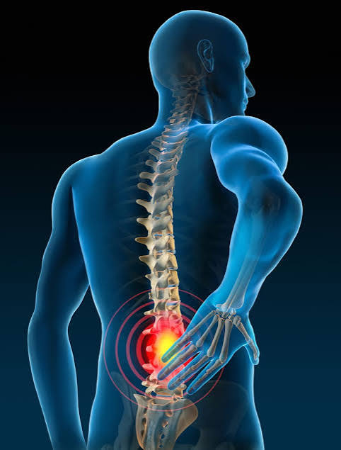 Back Pain